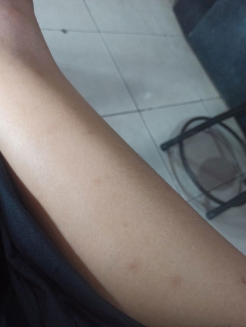 Bun
Ada yang ngalamin kaya aku juga gak ya? Gatal timbul merah bulat  di paha kaki tangan wajar ga?