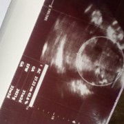 Tentang BB janin trimester 3