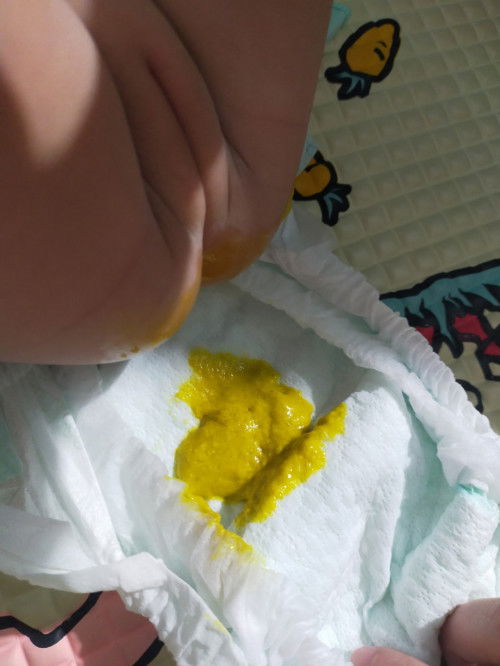 Tiêu hoá của bé