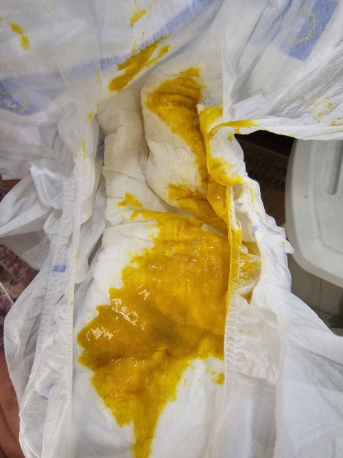 Diare sampai berhari hari bahkan hampir sebulanan