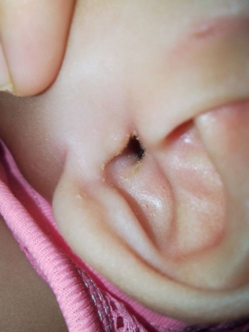 หูน้องเป็นอะไรคะ?