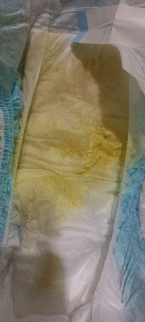PALE POOP after feeding