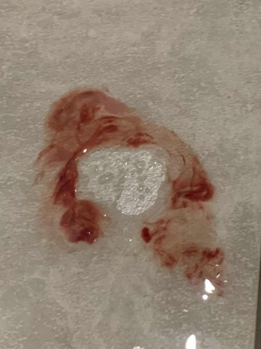 Bersama suami pada minggu 10