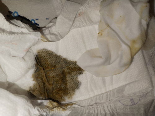 Tekstur poop baby hijau cair