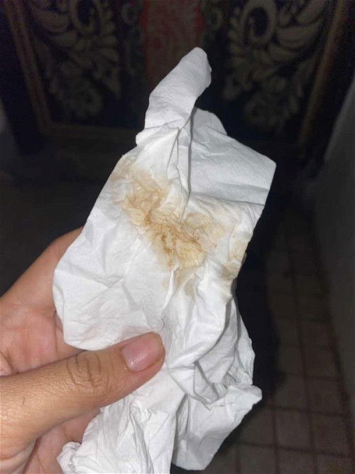 แบบนี้อันตรายมั้ยคะ