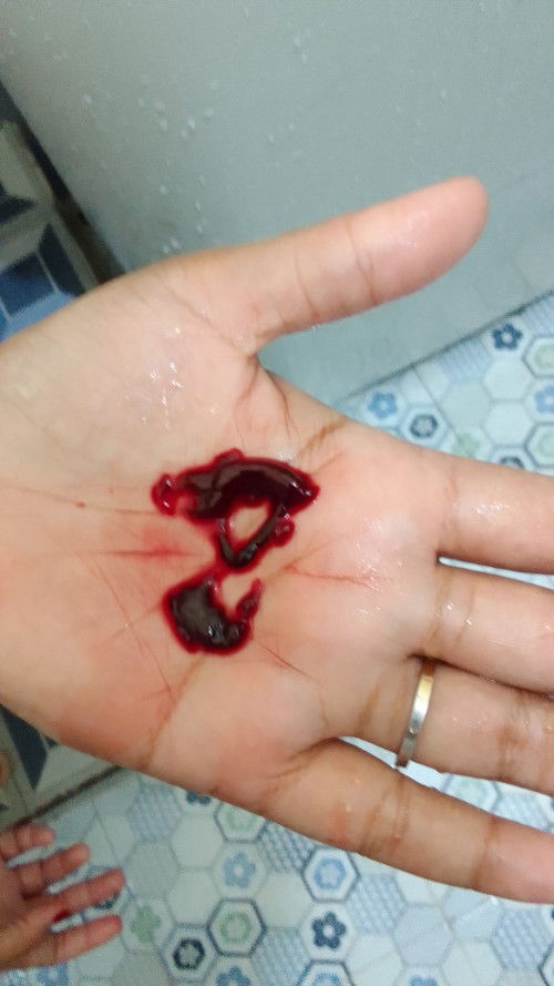 7 minggu 5 hari keluar gumpalan