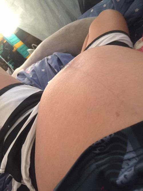 31+3 ท้องเล็กรึป่าวคะกลัวลูกน้ำหนักไม่ตามเกณฑ์ค่ะ