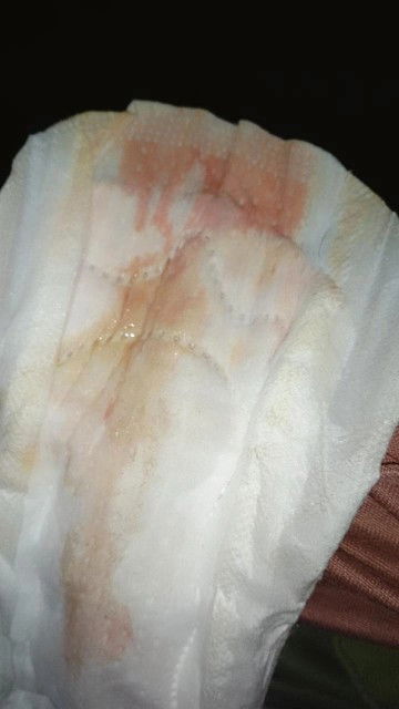 ขอสอบถามน้ำคาวปลา