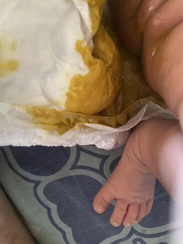 น้องถ่ายปกติไหมค่ะ