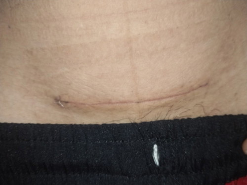 ขออนุญาตสอบถามแม่ๆค่ะ