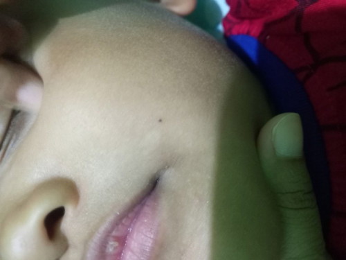 Anak ku pipi ada bercak putih kayak panu gtu, ada rekomen baby cream yg bagus gak??