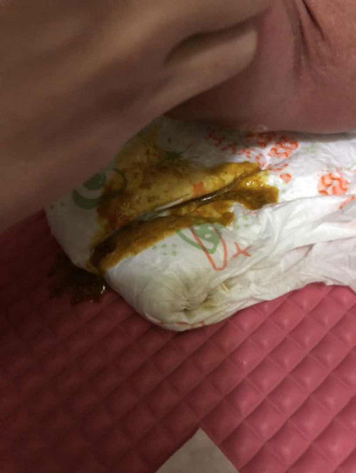 Dumi ni baby after breastfeed