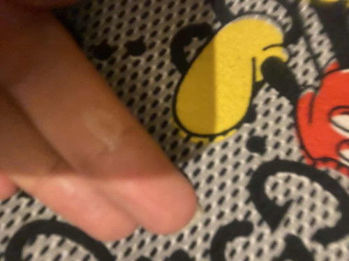 มีมูกใสแบบนี้เป็นตกขาวหรืออะไรคะ