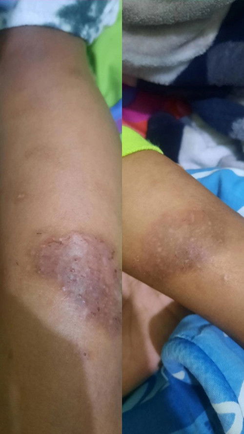 Sharing CREAM KULIT SENSITIF anak