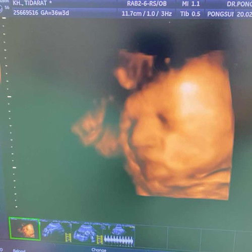 เจ้าจิ๋ว36week