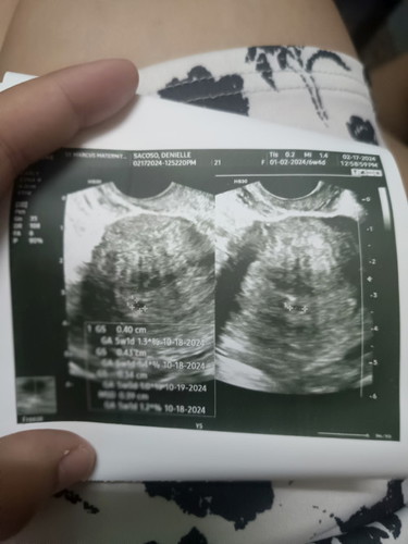 5 weeks pregnant, meron na po ba nito? Makapal na daw po lining ko sa mattress, positivenadinposa pt