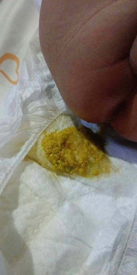 Every after feed tumatae si baby at ganyan ang itsura.