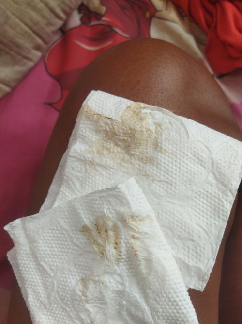 39+1wเป็นแบบนี้