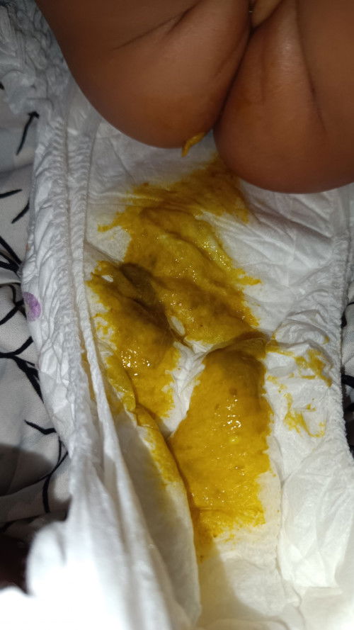 Pup cair dan berlendir