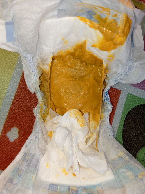 concern about poops ni baby