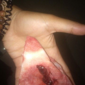 Sedihnya bget bun
Setelah pendarahan masih pegel pinggang belakang?