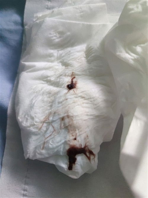 ปรึกษาปัญหาครับ