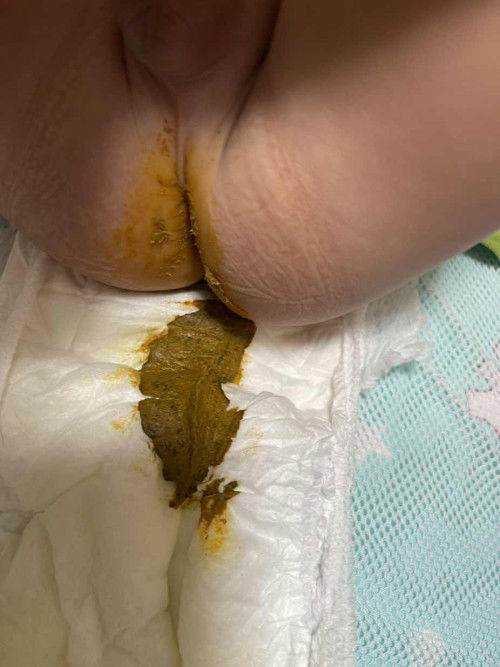 Phân bé 7 tháng vậy có ổn ko ạ