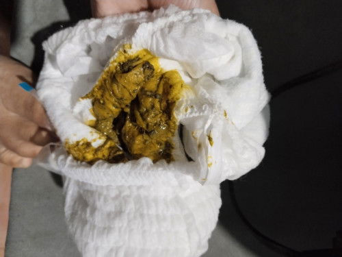 อึของลูก