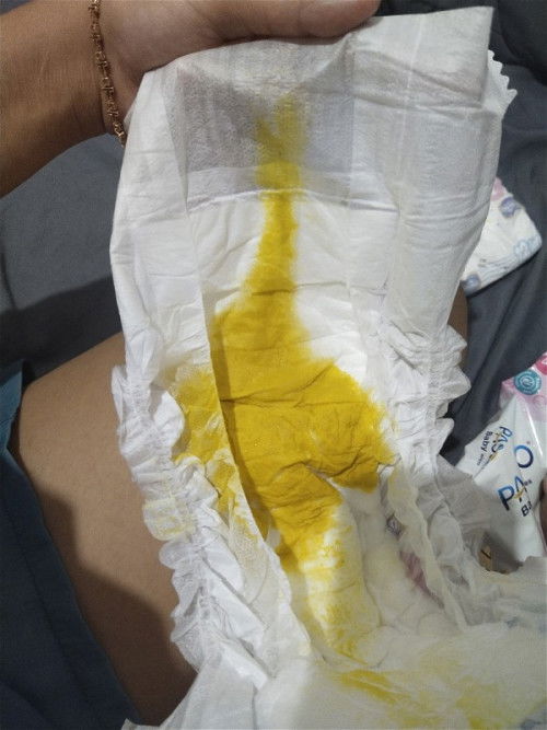 Pup bayi tanpa ampas