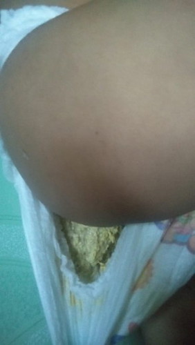 BAB anak 1 thn warnanya agak putih
