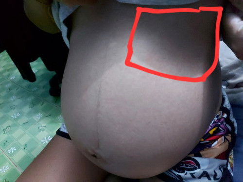 เจ็บท้องรู้สึกเหมือนอะไรทิ่ม