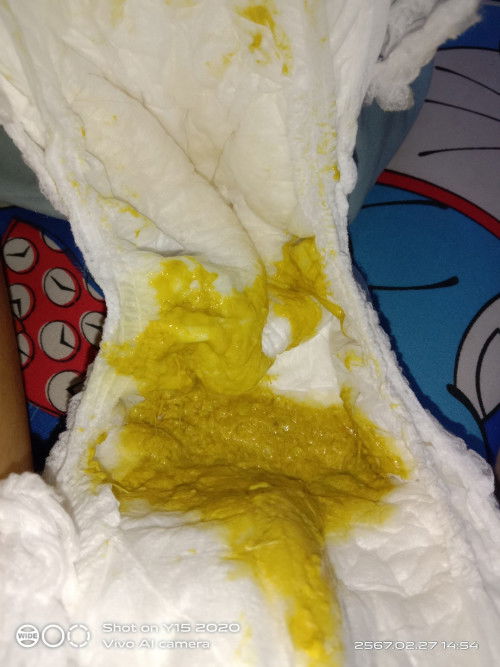 ลักษณะของอึลูกแบบนี้ปกติไหมคะขออภัยคนกำลังทานข้าวค่ะ