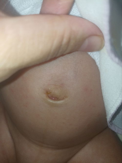 Pusat bayi 1 bulan masih basah