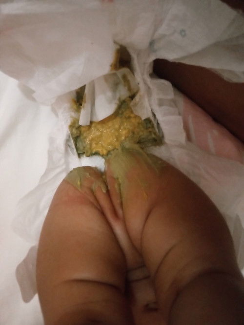1month poop (Formula Milk)