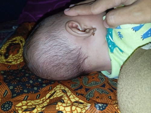 Kepala bayi peyang