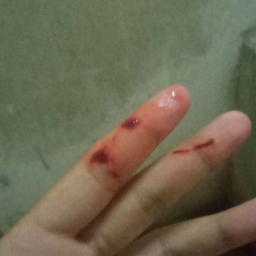 มีมูกเลือด