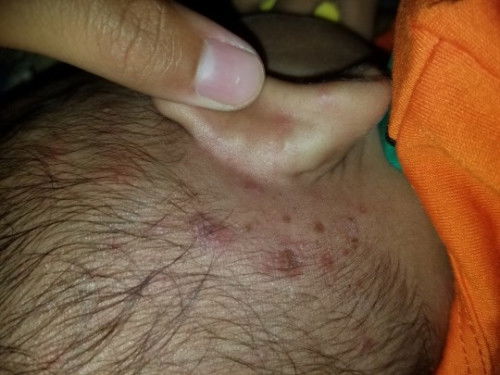 Ada g yg anak nya prnh ky gini trs di kasi apa ya biar smbuh