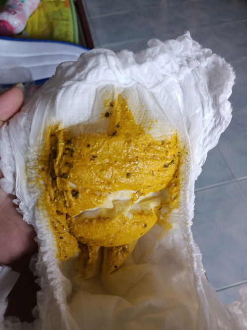 ลูก4เดือน อุจจาระปกติไหม