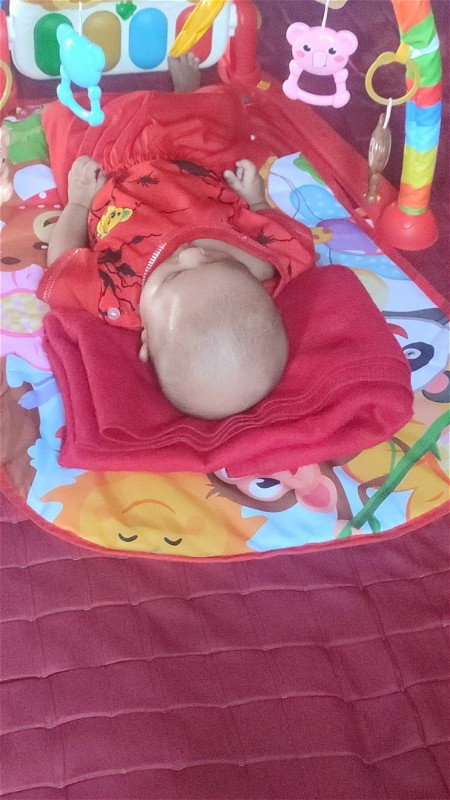 Kepala baby plagiochepaly