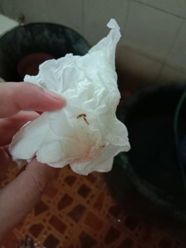 ตรวจปากมดลูก