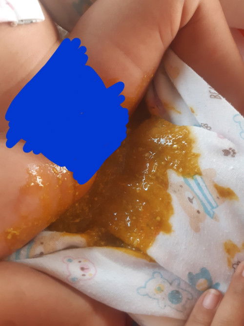 น้องท้องเสียหรือป่าว