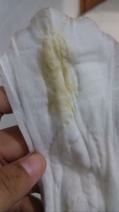 Keputihan berwarna kuning