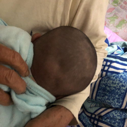 หัวลูกยุบเป็นปกติมั้ยค่ะ