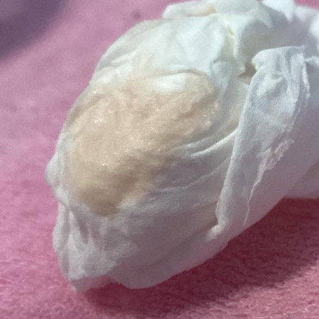 แบบนี้ใช่เลือดล้างหน้าเด็กไหมคะ