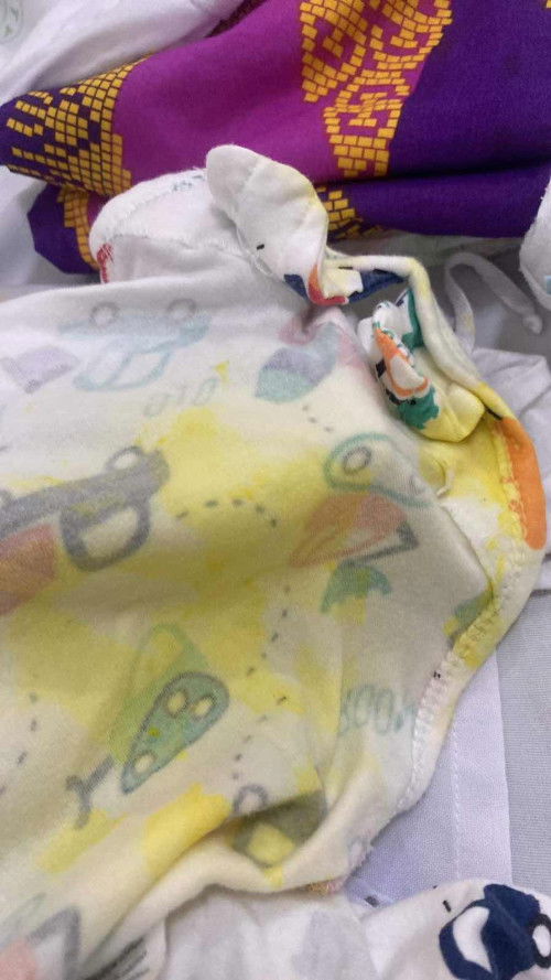 Color yellow na dighay/vomit ni baby at 6 days old