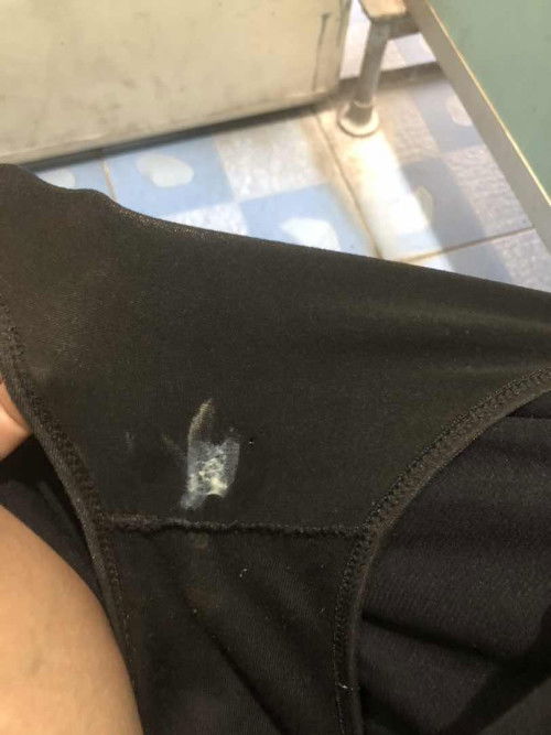 สอบถามแม่ๆตกขาวแบบนี้