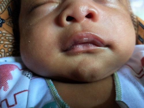 Tanya bund tolong dijawab yak.. kadang suka bingung newmom soalnya..