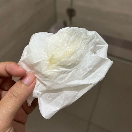 สอบถามอาการคลอด