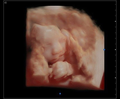 Hpht 03Agsts-28w3D-hpl 17mei