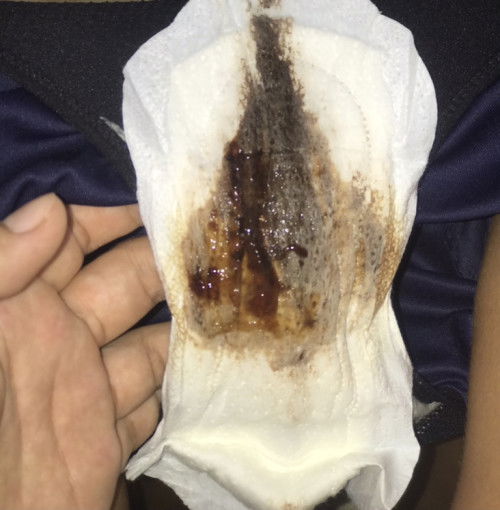 ขออภัยคุณแม่ทุกคนนะคะ 40+1